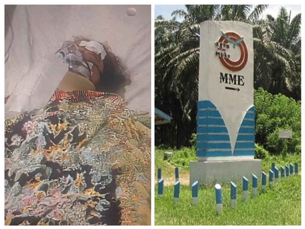 Kecelakaan Bus Sekolah PT Agromuko: Naira, Siswa SMAN 1 Mukomuko Masih Koma Akibat Terjatuh