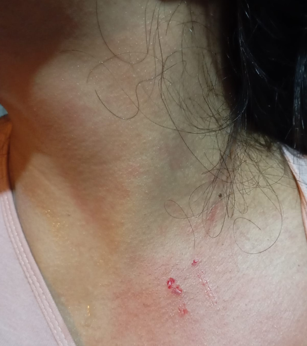 Penyidik Bripda Rilly Sagita Diduga Bohong Terangan; Janji Periksa Saksi KDRT, Malah Ditinggal Cuti 