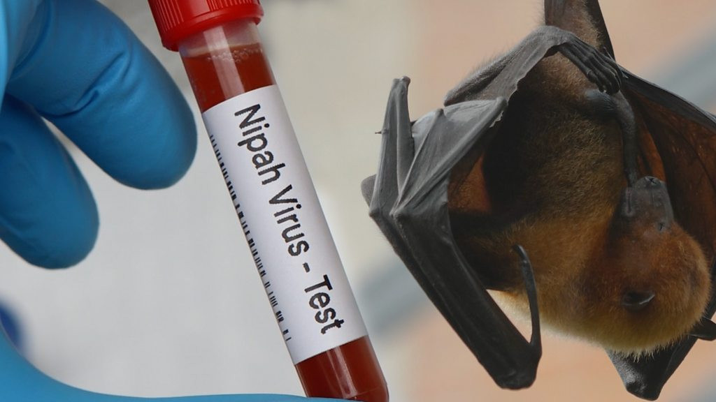 Virus Nipah Mewabah di India, Dokter Ungkap Bahayanya ke Otak