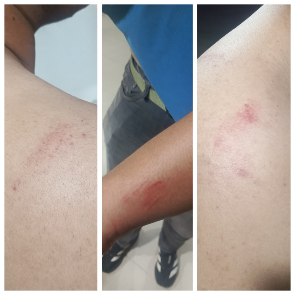 Anak Polisi Berusia 19 Tahun Dikeroyok Pak Ogah di Jalan Williem Iskandar Medan