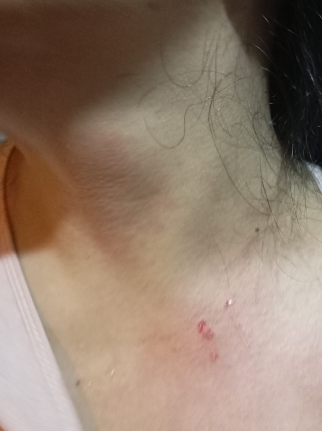 Kasus KDRT Sumut: Mengapa Yang Bantu Pegang Korban Tak Ditetapkan Sebagai Tersangka?