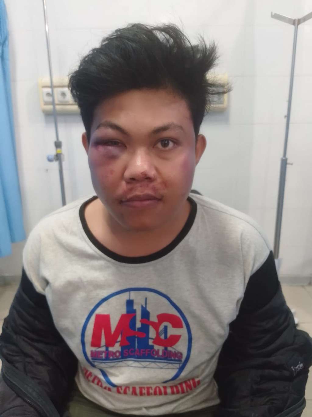 Penganiayaan di Samosir Buka Kembali, Korban Sebut Perdamaian Terjadi Dalam Kondisi Tidak Stabil