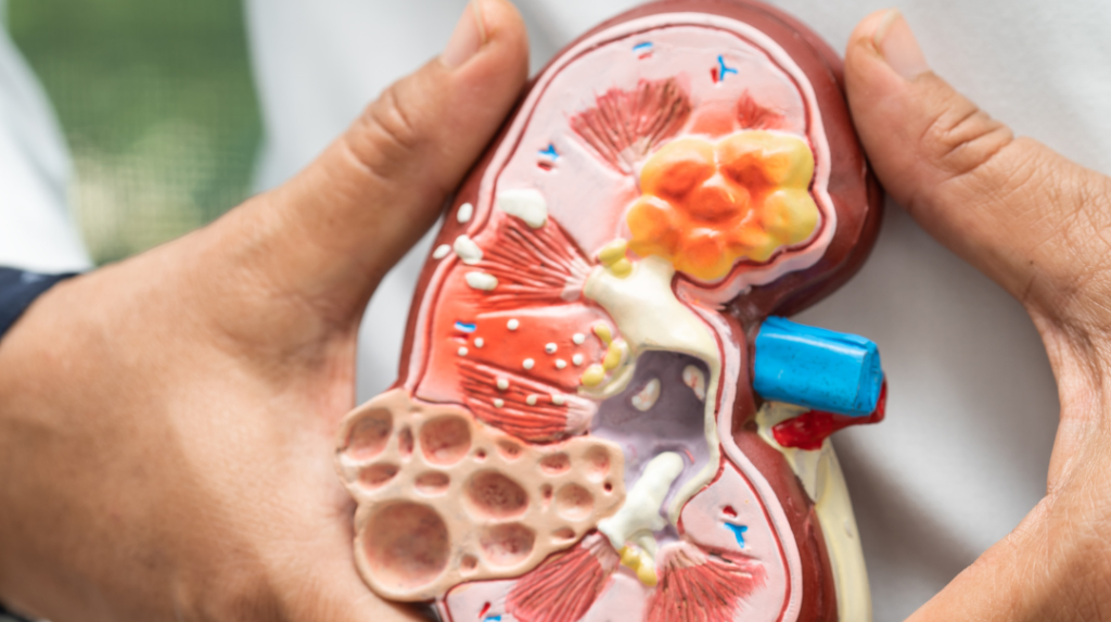 Dokter Ungkap Perubahan di Wajah yang Jadi Tanda-tanda Gagal Ginjal