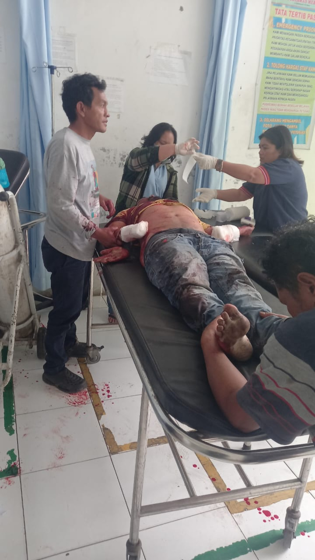 Lagi Minum Dikedai Kopi, Sagala Diserang dan Dibacoki,Tangan Kanan Putus,Warga Geger.