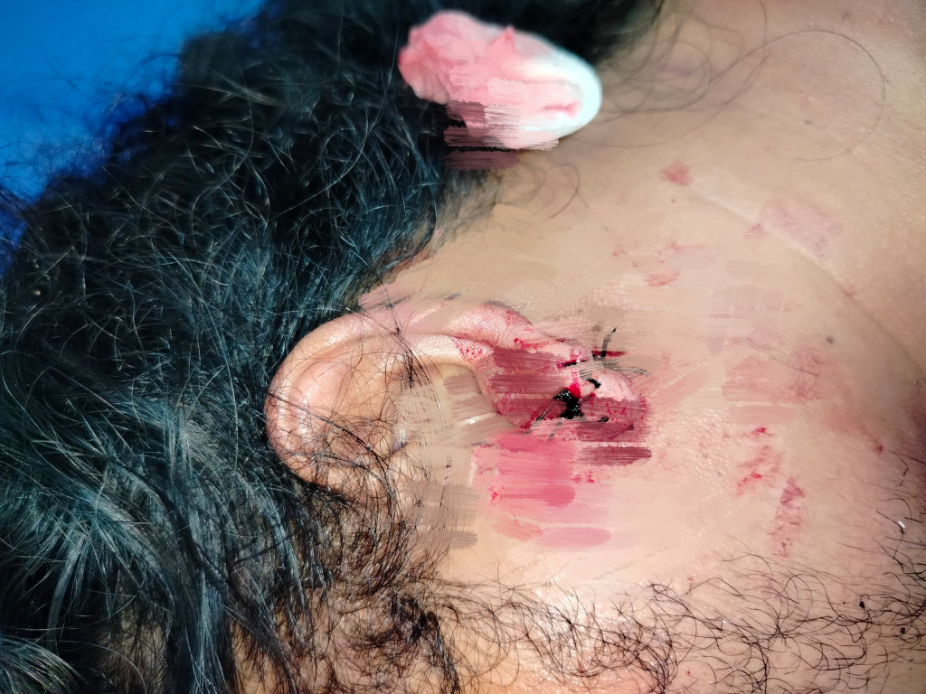 Laporan Pengeroyokan Diduga Jalan di Tempat, Korban Sebut Penyidik Polrestabes Medan Tidak Profesional