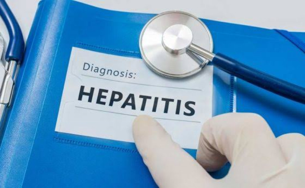 Hasil Sampel Pertama Kasus Hepatitis Misterius yang Dilakukan FKUI, Tak Ditemukan Adenovirus