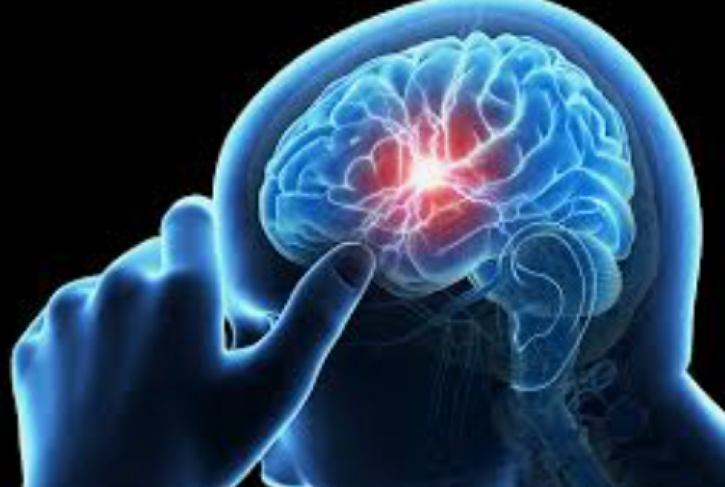 Jangan Abaikan, 5 Tanda Stroke Bisa Muncul Sebulan Sebelum Serangan