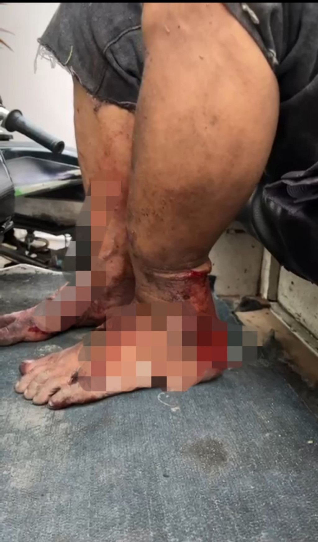 Berawal Cekcok, Abdullah Nasution Nyaris Tewas Dibacok Abang Ipar