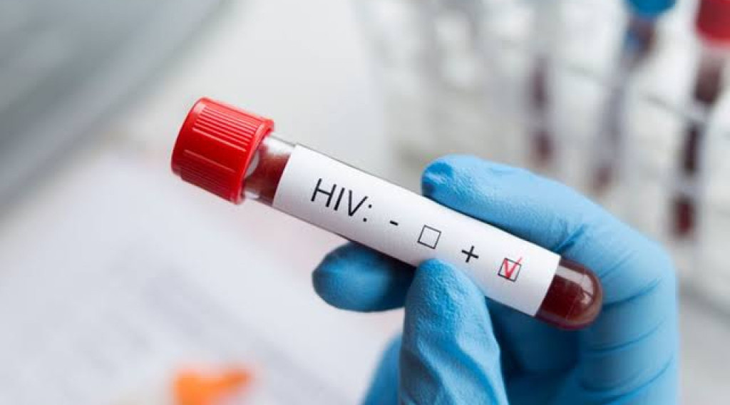 Di Negara Tetangga RI, Kasus HIV Melonjak Tambah 2 Orang per Hari