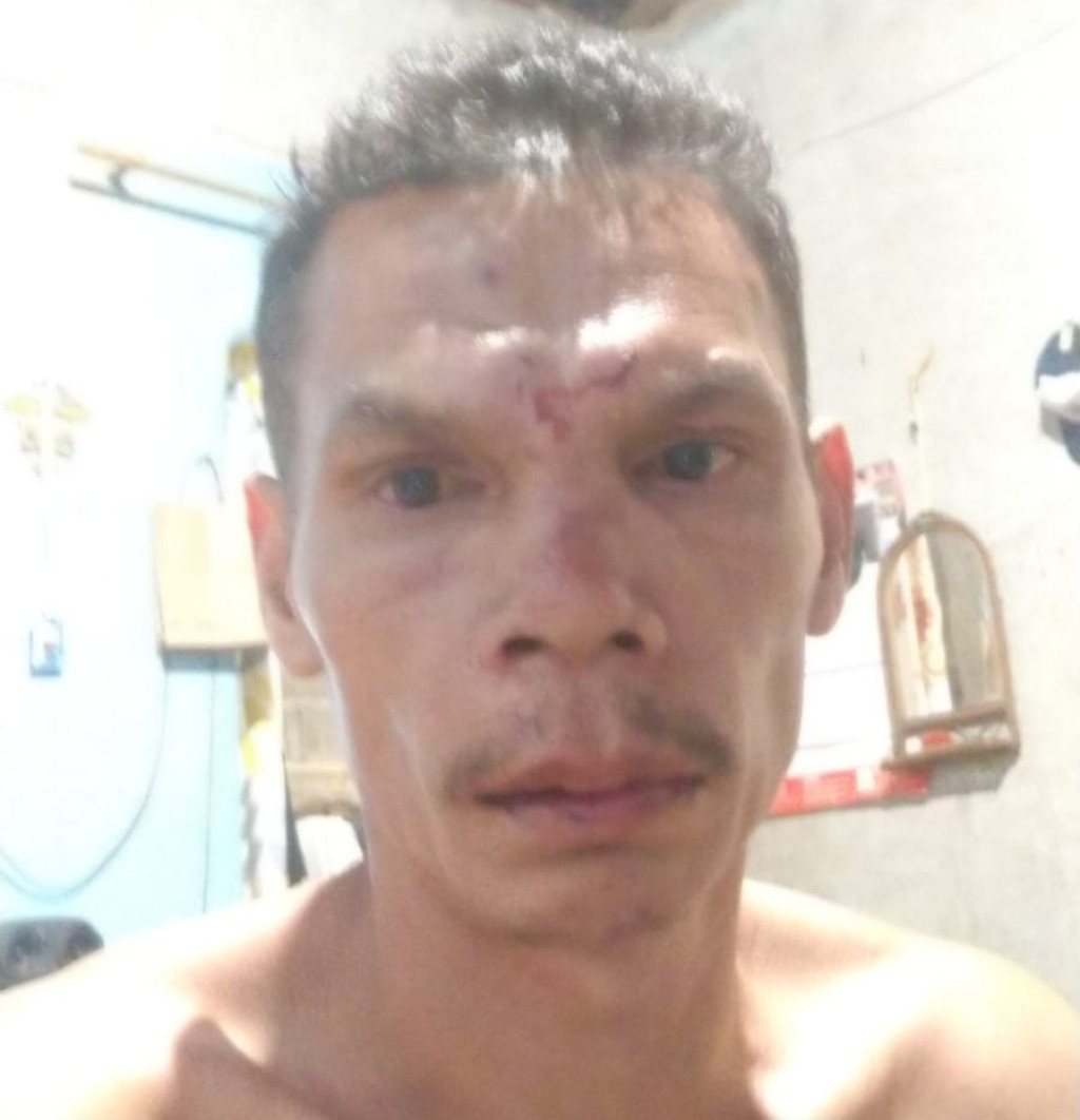 Korban Penganiayaan di Soban Dairi Desak Polisi Tangkap Pelaku