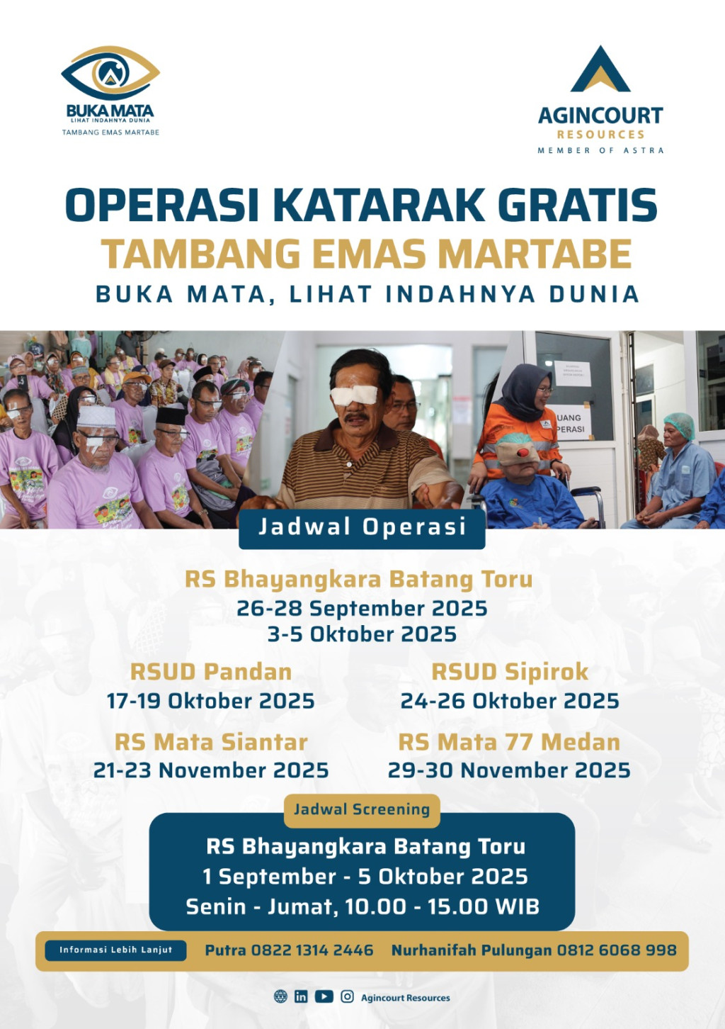 Target 1.400 Mata, Tambang Emas Martabe Kembali Gelar Operasi Katarak Gratis 2025