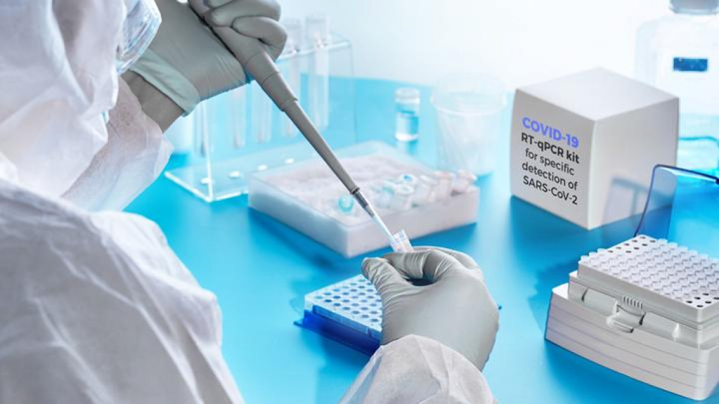 PHRI Apresiasi Keputusan Pemerintah Menurunkan Harga PCR