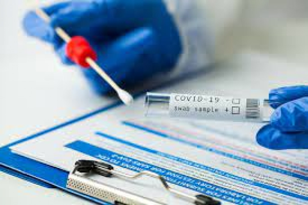 PHRI Apresiasi Aksi Pemerintah Turunkan Harga Tes PCR