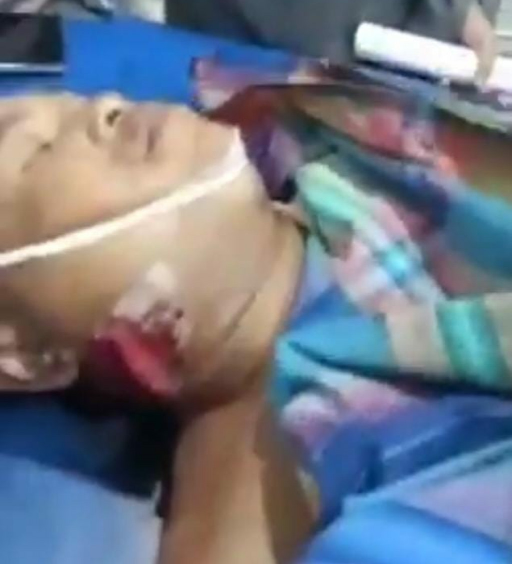 Warga Medan Belawan Tewas Tertembak di Pekan Labuhan, Begini Kronologinya