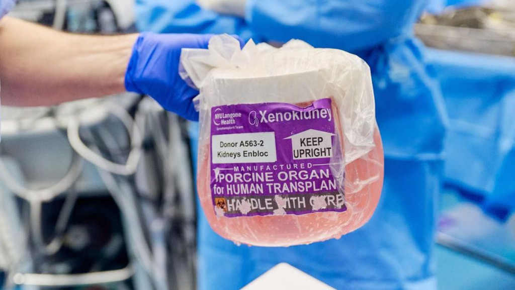 Studi NYU Ungkap Kemajuan Besar Menuju Transplantasi Ginjal Babi untuk Pasien Manusia