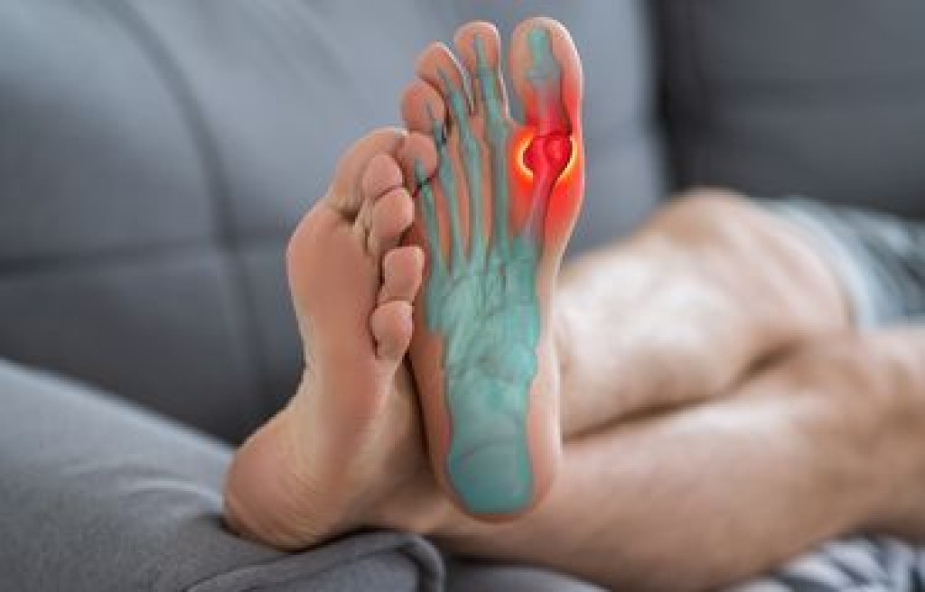 Daging, Alkohol, dan Dosis Obat: Tiga Faktor yang Bikin Asam Urat Sulit Sembuh